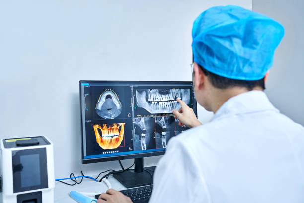 Best Emergency Tooth Extraction in Middletown, KY